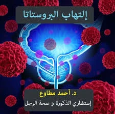 أسباب تضخم البروستاتا في سن مبكر