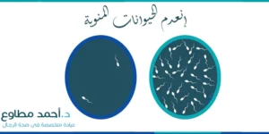 علاج انعدام حركة الحيوان المنوى